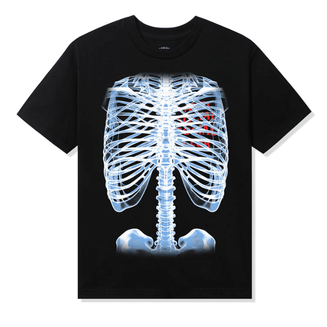 Anti Social Social Club Bones Tee - black